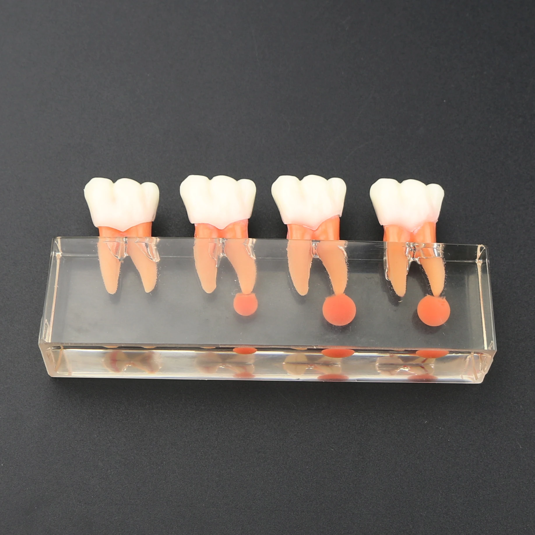 Model zębów dentystyczny M4018 Leczenie endodontyczne 4-etapowa próchnica kanału molowego do studiowania nauczania