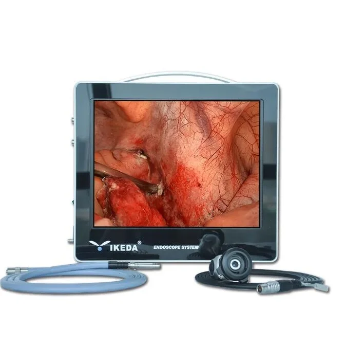 IKEDA All-in-one ENT Endoscopy Portable Full HD Price YKD-9115E