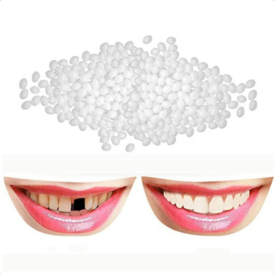 Tooth Repair Kit Instant Fixing TeethTemporary Teeth Replacement Kit for Repairing Damaged and Missing Teeth