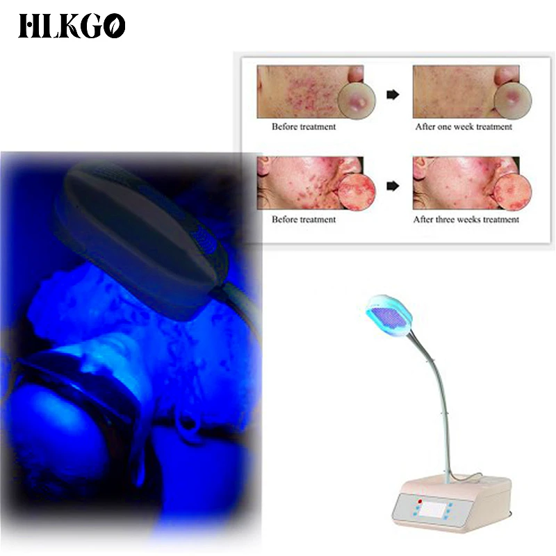 Terapia de fotones LED Facial recargable, máscara de belleza, rejuvenecimiento de la piel, estiramiento Facial en casa, dispositivo de belleza blanqueador