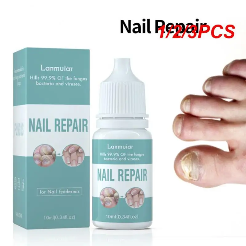 Fungal Serum Nail Repair, Foot Toe Nail, Fungus Atreatment Gel, Anti Paroníquia, Onicomicose, Cuidado, TSLM2, 15ml, 1 Pc, 2 Pcs, 3Pcs