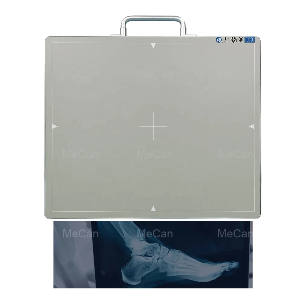 Cheap Digital Radiography Wireless Flat Panel Detector Xray DR System Portable Medical X-ray Flat Panel X Ray Detector with PC