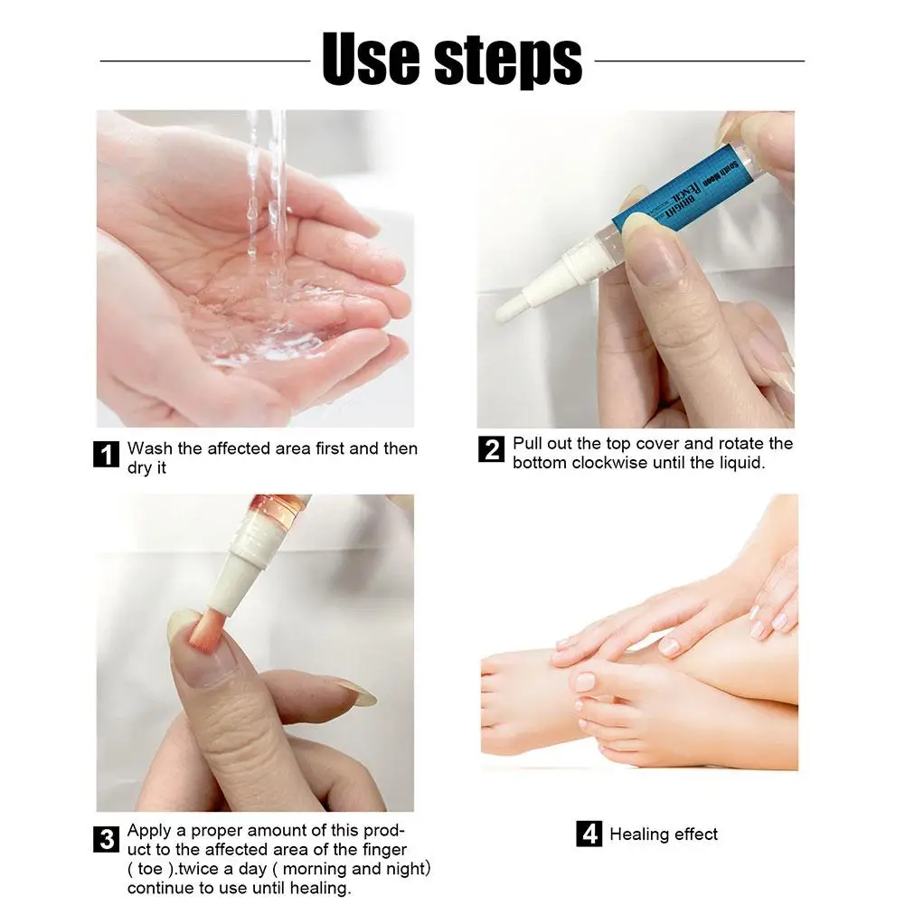 Onicomicosi Riparazione Penna Liquida Paronichia Cura Delle Unghie Trattamento Cracking Unghia Del Piede Rimozione Fungine Siero Anti-Infetivo Yellowi A0Y0