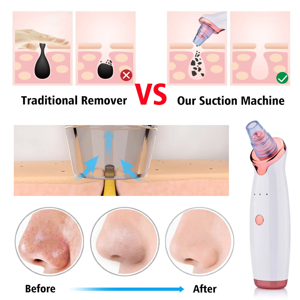 Electric Vacuum Blackhead Removal Facial Cleansing Black Spots Suction Acne Pimple Remover Beauty Instrument Skincare Tools