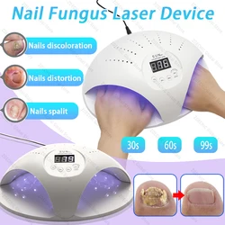 2-In-1 Fungal Nail Laser Device Repair Fast Nails Fungus Onychomycosis Repair Toenail Fingernail Removes Nail Fungus Foot Care