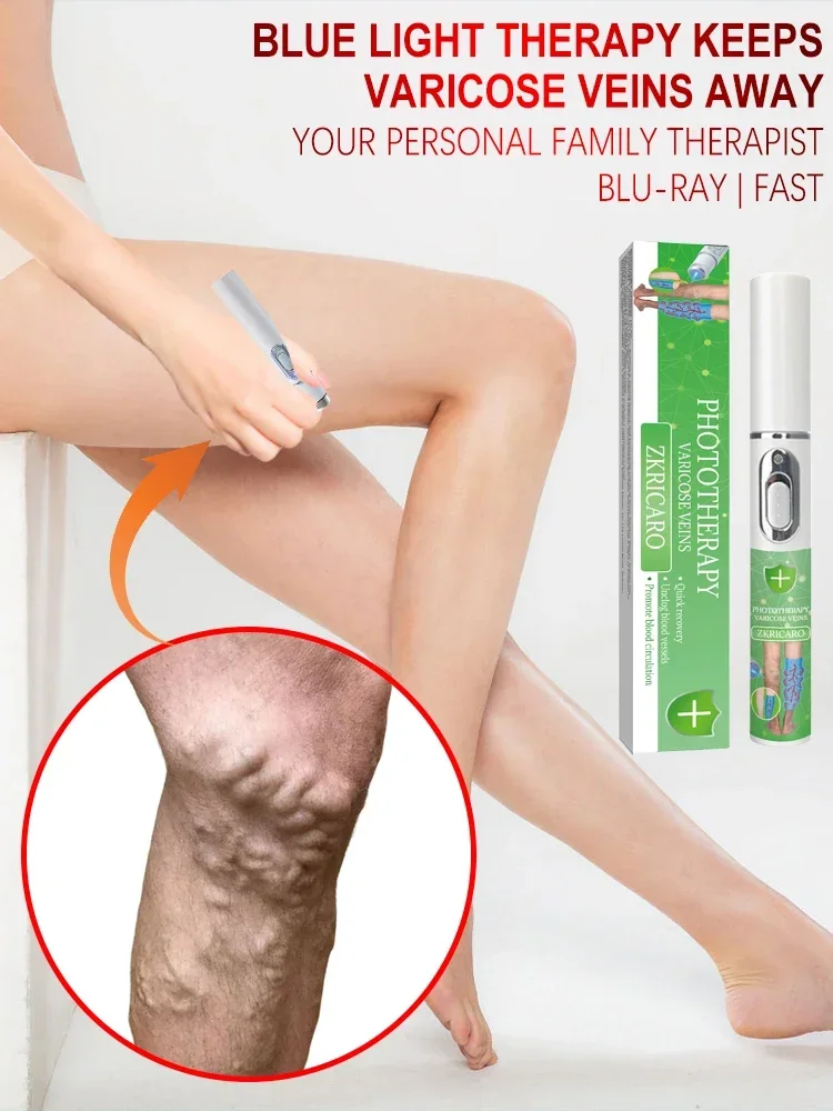 Laser Varicose Vein Products