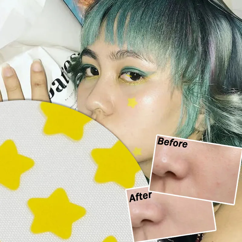 

Star Buttterfly Pimple Patch Acne Concealer Face Spot Y2K Coloful Invisible Acne Removal Skin Care Stickers Beauty Acne Tool