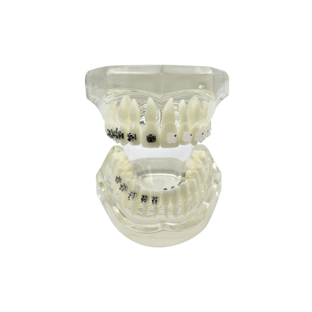 

Dental Model Teeth Teaching Model With Self Ligating/ Metal/ Lingual/ Ceramic Orthodontic Brackets Teeth Model For Studying Demo
