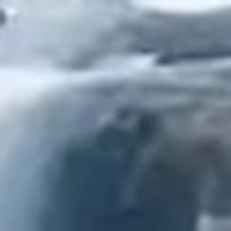 

Medical Sprague Rappaport Professional Doctor Neonatal Adult Nurse Cardiology Estetoscopio Dual Head Gilt Cute Stethoscope C3