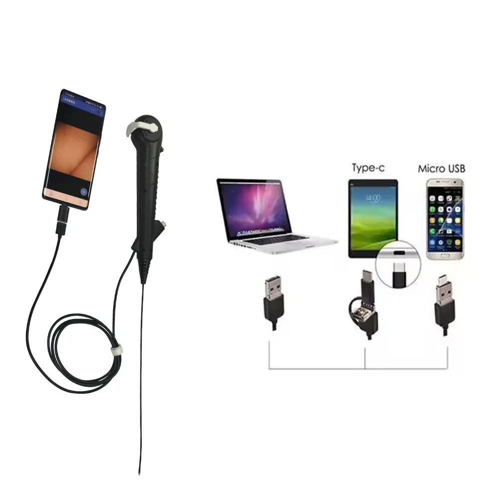 CRW Smartphone-Link Super Slim Ureteroscope USB/Type-C Direct Connect Disposable    OEM/ODM Single-Use Flexible Scope