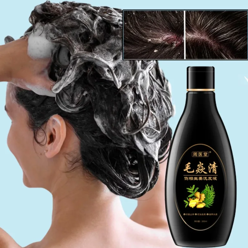 

Hair Follicle Shampoo Nourishing, Deep Cleaning Anti Dandruff Relieves Itchy & Dry Scalp
