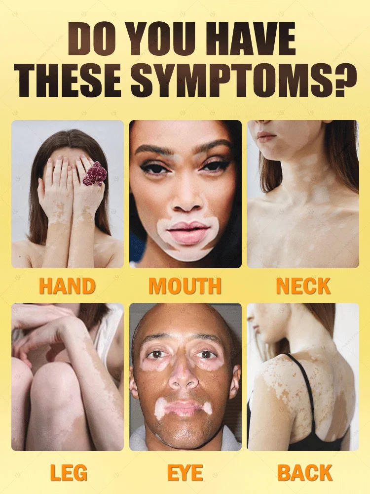 sa1564af61sa1d51a6s51