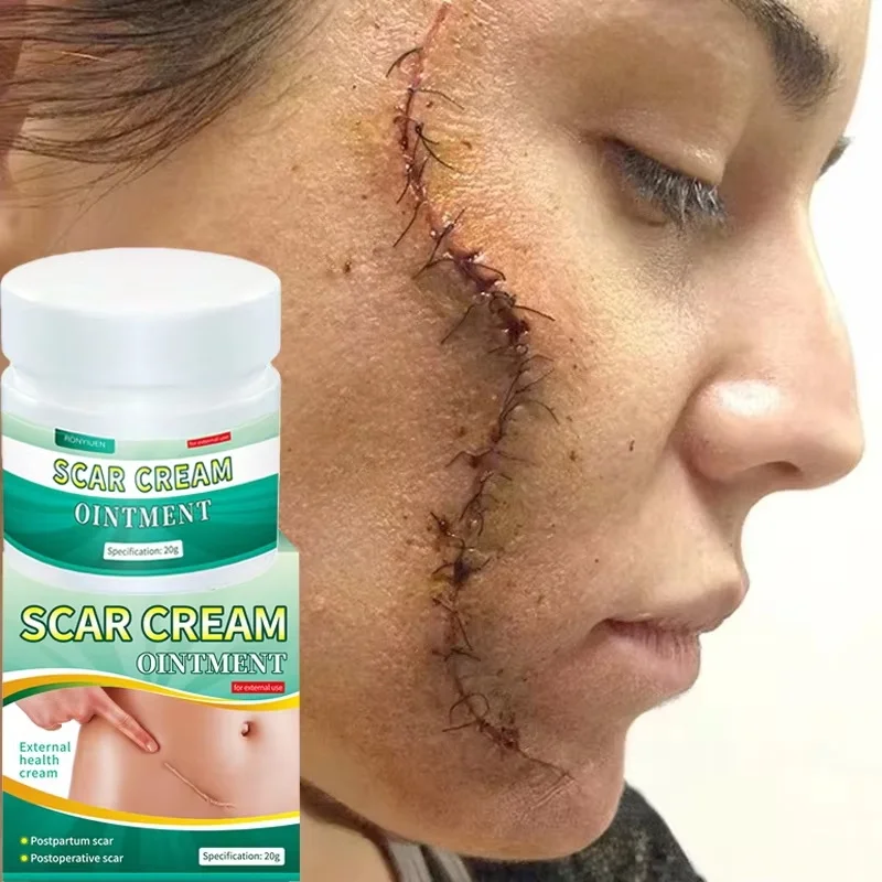 Fast Scar Removal Cream Effective Treatment Stretch Marks Burn Surgical Scars Gel Repairing Acne Whitening Smoothing Skin Care