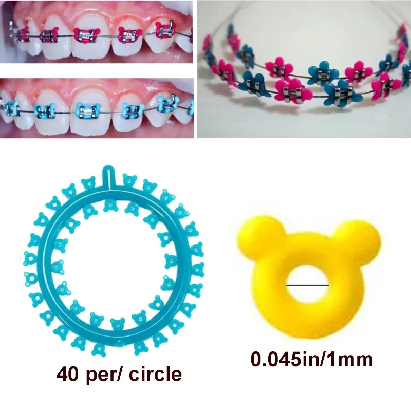 1000 Stück Zahnspangen-Ligaturen, O-Ringe, elastische Ringe, Zubehör für Zahnspangen, Cartoon-Blumen-, Mickey- und Katzen-Designs – Detail 2