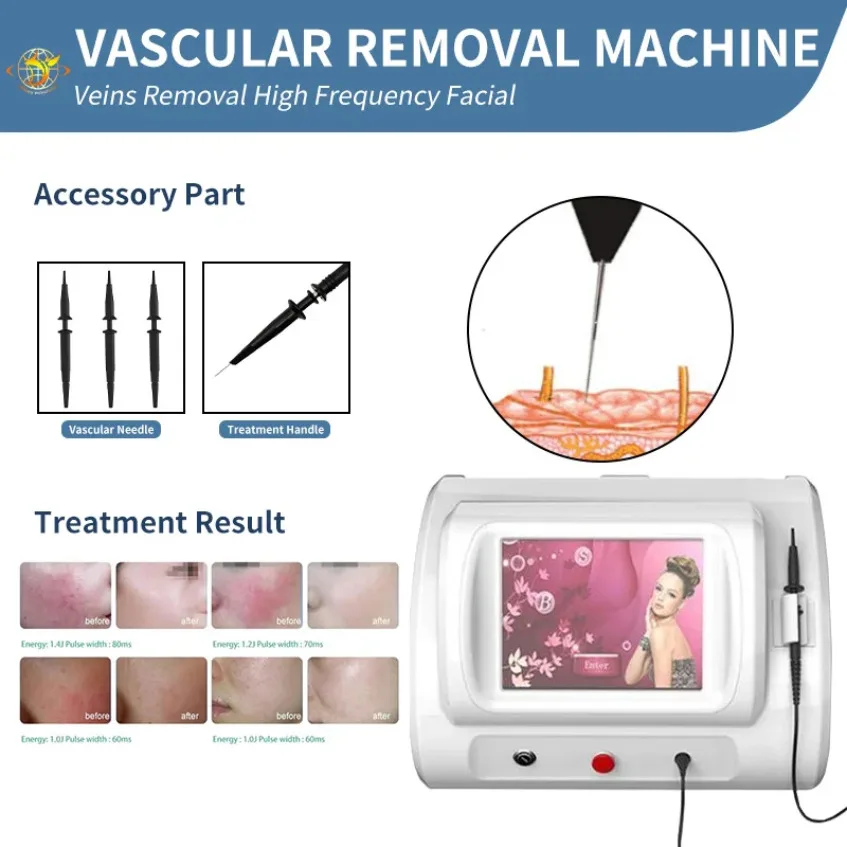 Trending High Frequency R-F Vascular Removal Machine Beauty Equipment