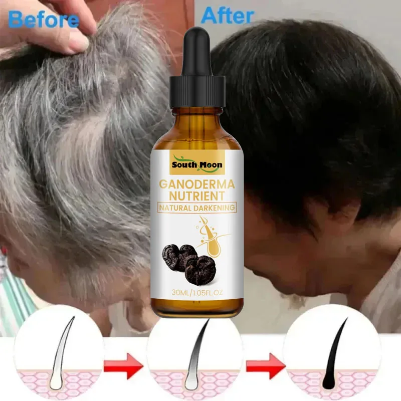 

Gray White Hair Treatment Serum Natural Color White To Black Anti Hair Loss Liquid Repair Nourishing Scalp Care For Men Women