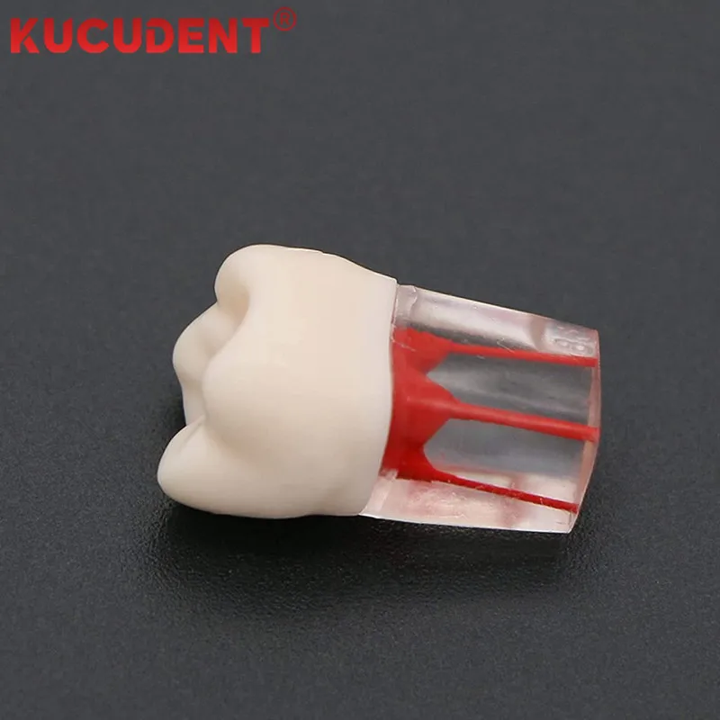 Dental Model Endo Teeth Root Canal Models Endodontic File RCT Practice Block Pulp Cavity Training Lab for Student Teaching Study