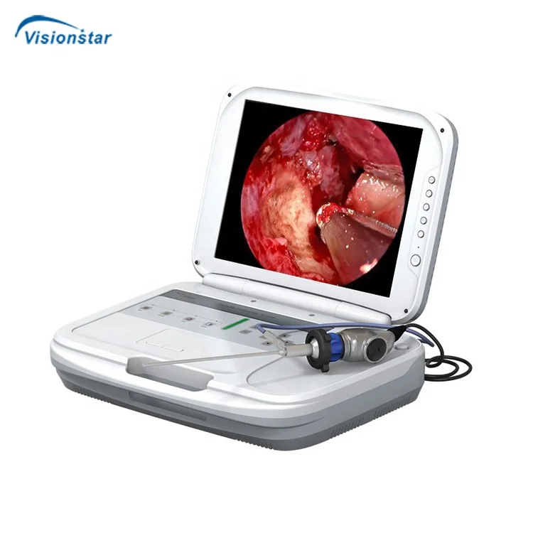 Medical Digital Veterinary Integrated HD Endoscopy System Vet Endoscope