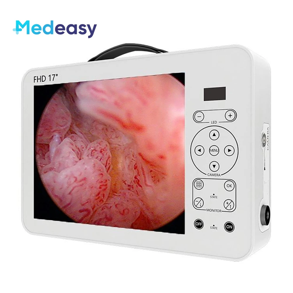 

Portable Full HD Endoscopy Unit All In One 17 Inch Medical Endoscope Camera System with LED Light Source