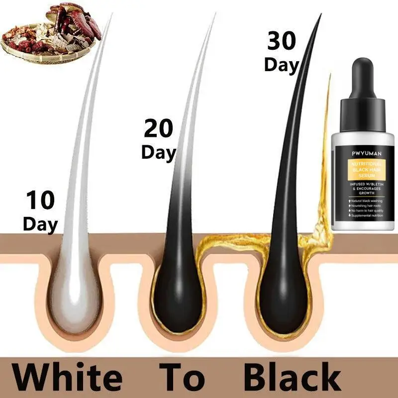 White Hair Treatment Essence Repairs Natural Color Prevents Gray Hair Shampoos  Anti Loss Hair Rgrowth Men Women Care Products