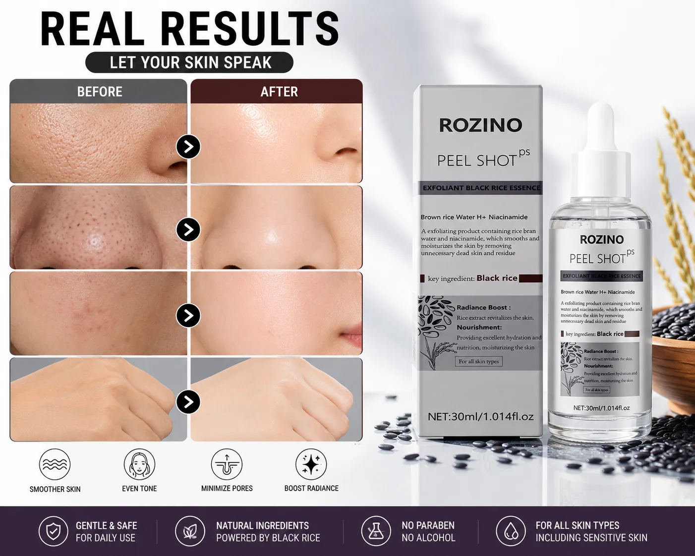 ROZINO Rejuvenating Black Rice Essence has a light and refreshing texture, quickly absorbs into the skin without leaving any sticky residue. Rich in black rice extract and nourishing ingredients, it gently cares for facial skin, soothes dull and rough skin, and softly brightens the skin for a translucent texture. It continuously replenishes moisturizing nutrients, alleviates dry and tight skin, and is suitable for daily facial rejuvenation and moisturizing care for various skin types.