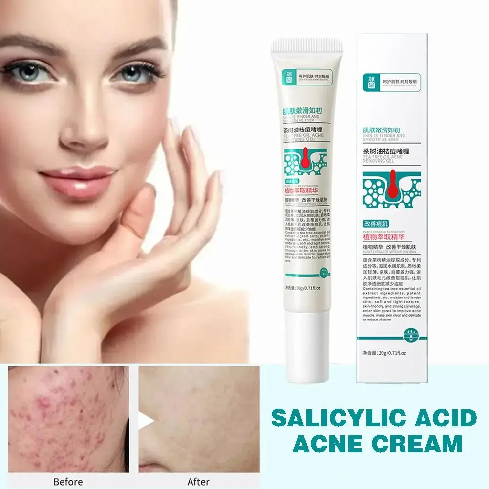 Crema de eliminación de acné, tratamiento de acné con ácido salicílico, cuidado facial, marca de contracción, elimina el aceite, elimina los poros, elimina el Control Ac J2F2