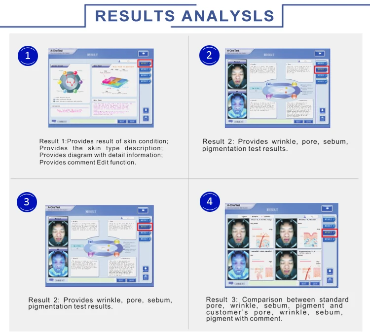 Factory Price CE Approved Professional Skin test Facial Analysis Skin Analyzer Machine/skin Analysis Device