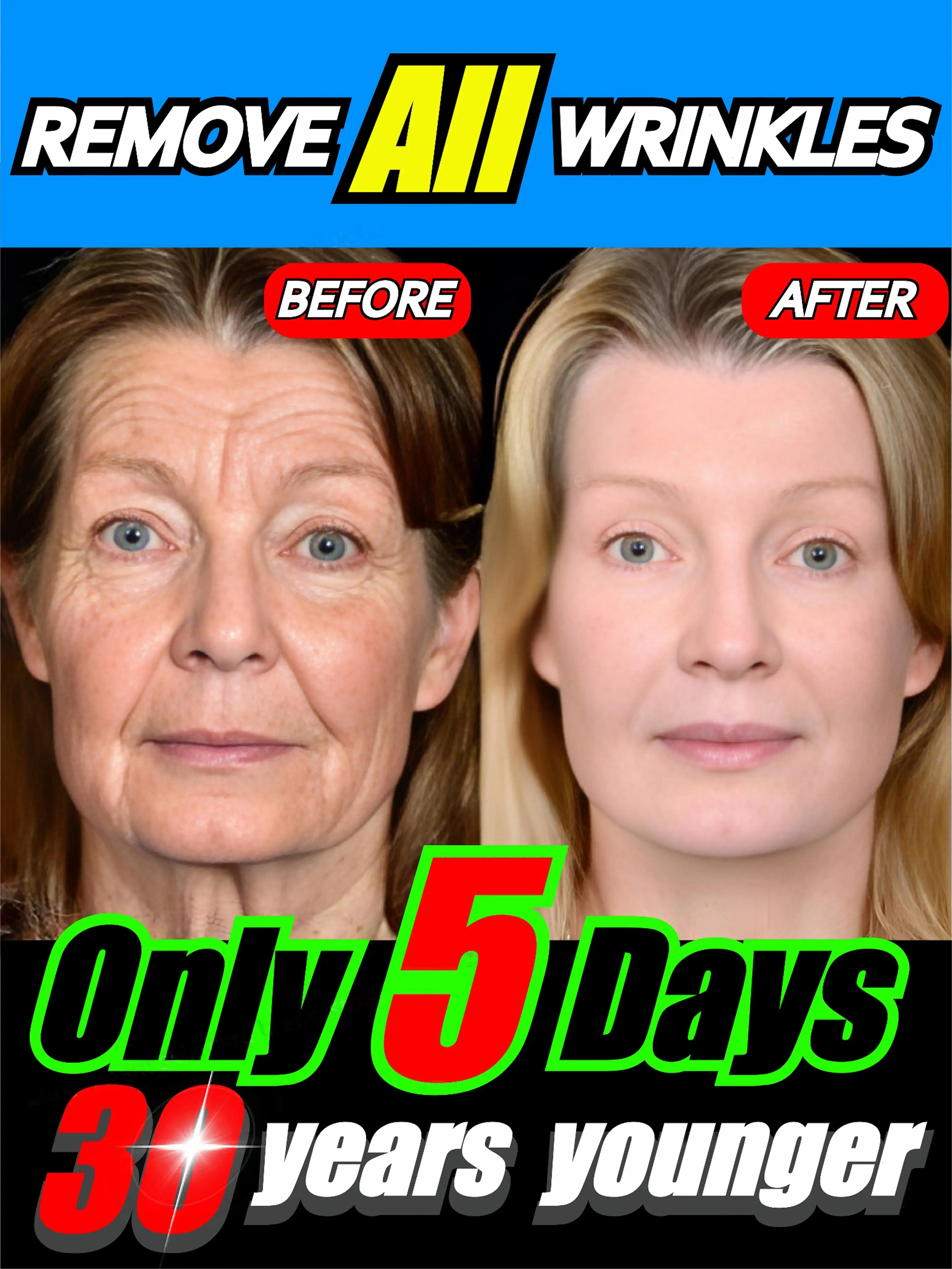 

wrinkles disappeared