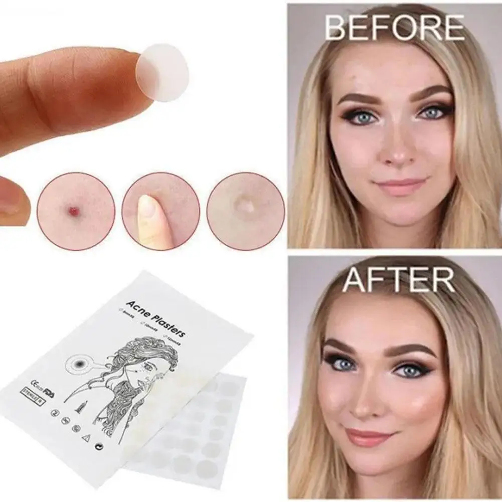 Invisible Acne Mask Pimple Patch Waterproof Acne Treatment Pimple Stickers T Acne Remover Facial Mask Skin Care