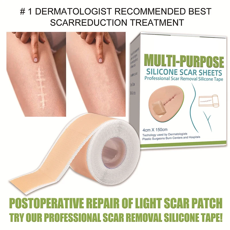 실리콘 흉터 패치 4cmx1.5M 피부 재생 시트 제거 자가 접착 스트레치 마크 테이프 치료 패치 화상 여드름 흉터 피부 관리 ﻿