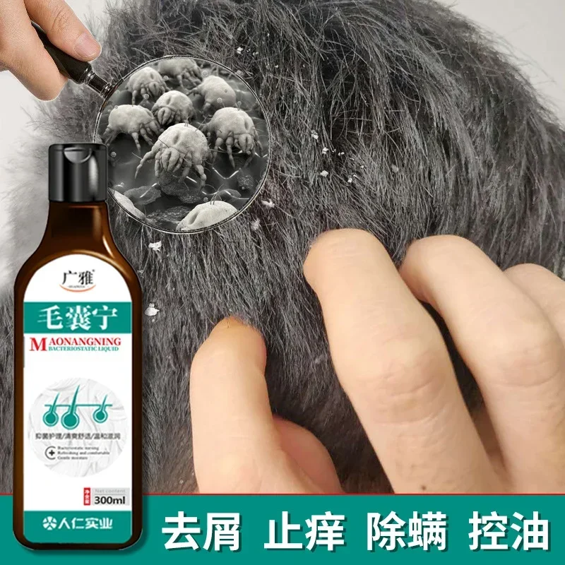 

Anti-Dandruff Anti-Itch Shampoo Chinese Herbal Hair Care Mite Folliculitis Seborrheic Scalp dry shampoo шампунь для волос