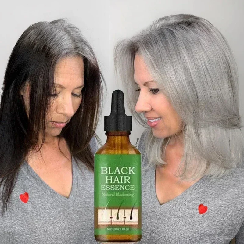 HOT~Black Hair Liquid Removes Grey Hair in Old Age Natural Anti-white Ahair Effective for Natural Ahair Color and Restore Black