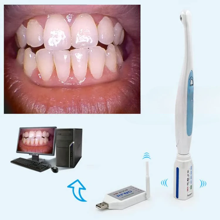 Endoscope 2 million high-definition camera images wirelessly transmitted for endoscopy