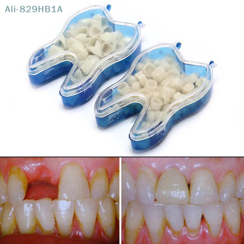 前歯と後歯用の一時的な王冠、磁器の歯の王冠、口腔機器、50個