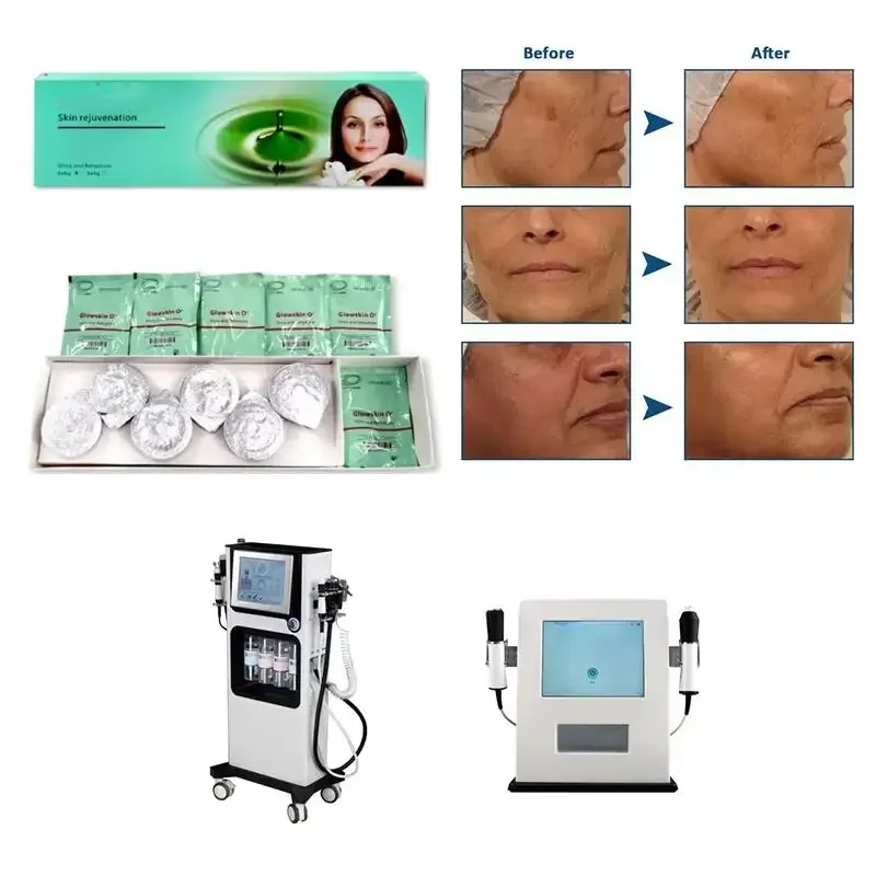 フェイシャルスクラブケアソリューション 水性角質除去ディープフェイシャルクレンジングソリューション 美白と若返り効果 SPAに最適