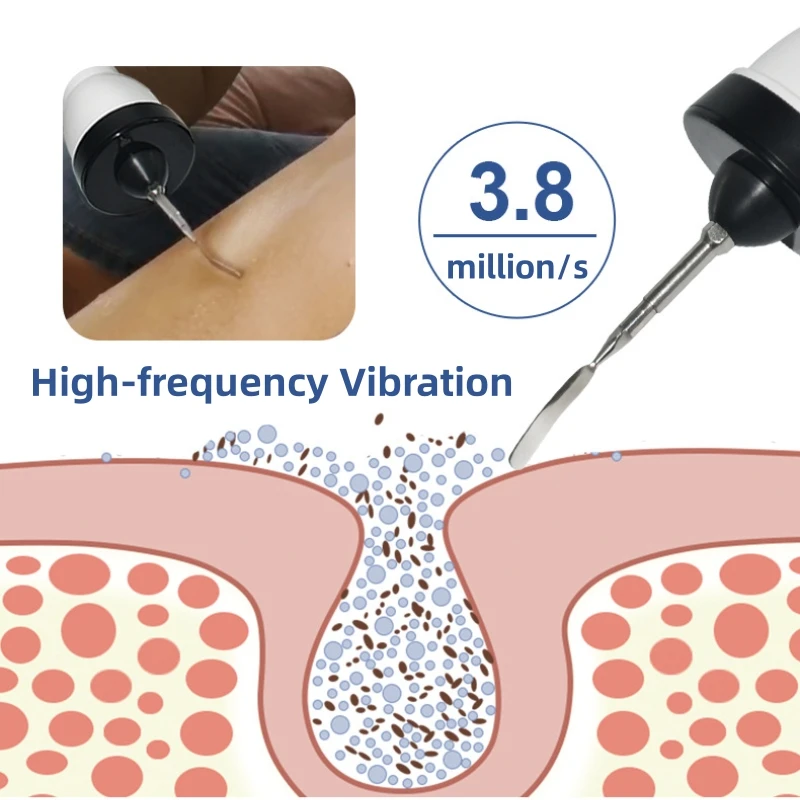 متعددة الوظائف الكهربائية الجلد الغسيل تقشير مزيل الرؤوس السوداء تنظيف الوجه العميق رفع أيون حب الشباب المسام الأنظف تنظيف الوجه #6