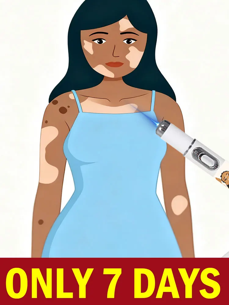 Hot Vitiligo Device 2nd Upgraded Version