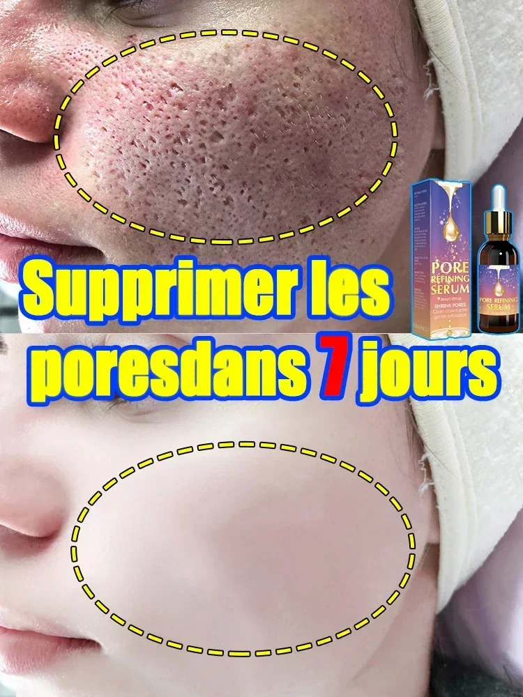 Pore Shrinking Serum Shrink Pores Cream Lactobionic Acid Face Firming Korean Skin Care