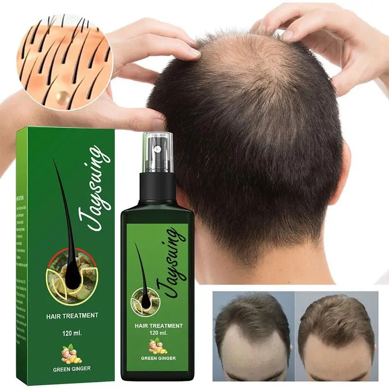 Ginger Hair Growth Serum Spray - Scalp Treatment Nourish Hair Root Strengthen Prevent Loss Repair Follicle Smooth Essence Nutrie