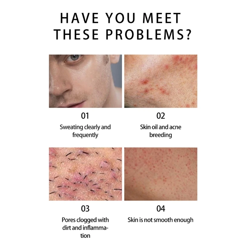 ผู้ชายสบู่บาร์ Cedar Citrus ผู้ชายสบู่ธรรมชาติกลิ่น Clear Skin Face Cleanser Dropshipping