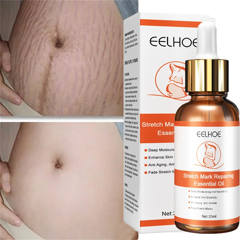 Stretch Marks Permanent Removal Serum Effective Treatment Stretch Marks Burn Surgical Scars Anti-Aging Firming Smooth Body Care