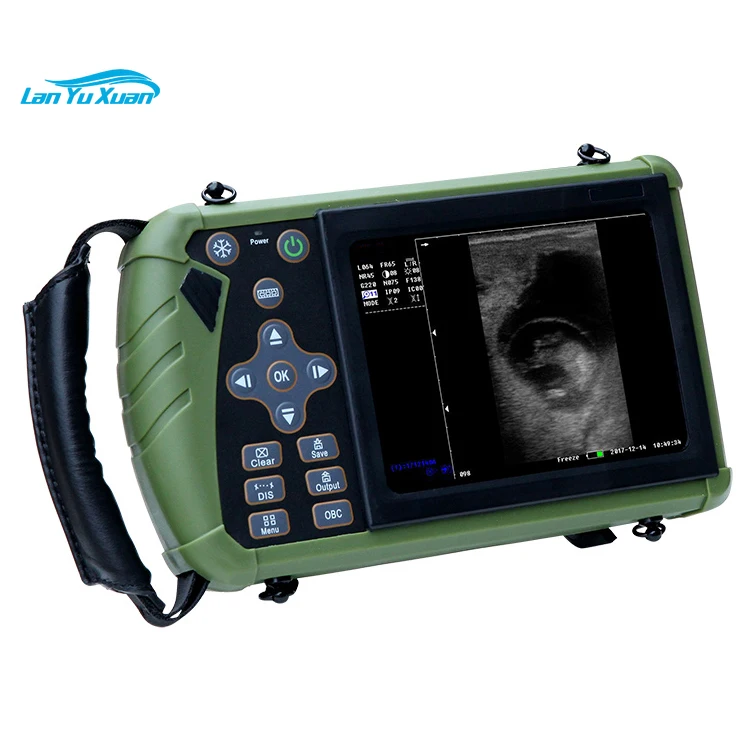 

KBW-V6 Palm Ultrasound Scanner(ultrasonicblack whiteImaging System)