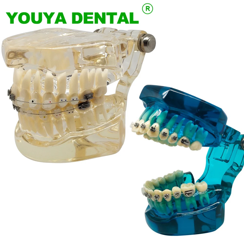 Dental Orthodontic Teeth Model With Ceramic And Metal Brackets Upper And Lower For Dentistry Demonstration Patient Communication