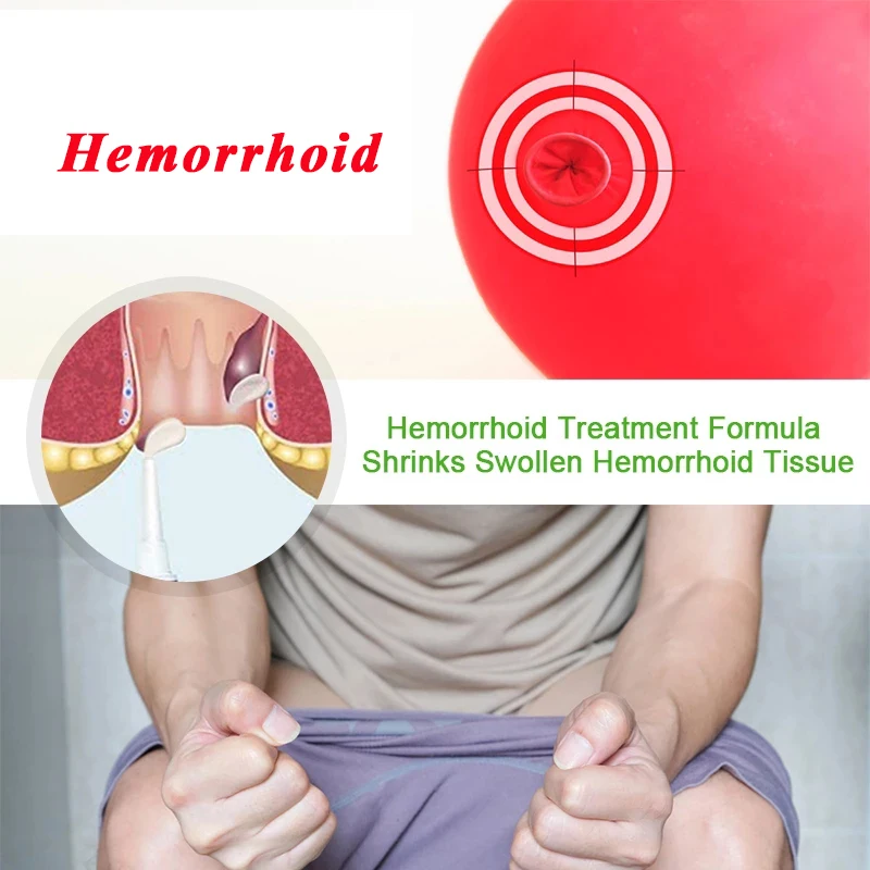 20G HUATUO Hemorrhoids Ointment 100% Original Chinese Cream Painkiller Pain Relief External Anal Fissure Medical Plaster P1002