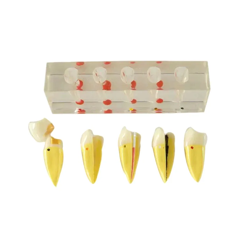 

Dental Pulp Disease Clinical Teeth Model for Teaching Learning