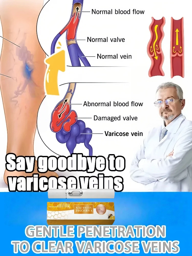 

yfor Anyone with Sedentary or Standing | vein pillow | veins exercise | veins trainer