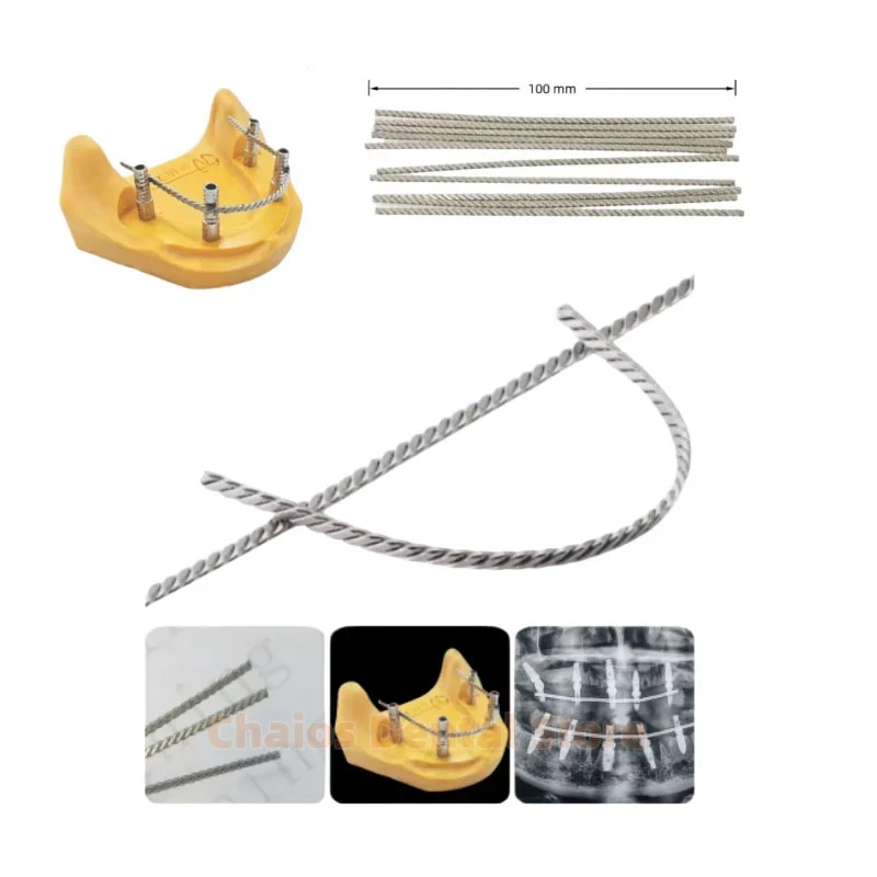10Pcs/Lot Dental Implant Connector Stainless Wire for Overdenture MU Implant Wire Can Be Welded or Bonded MU Wires Strengthener