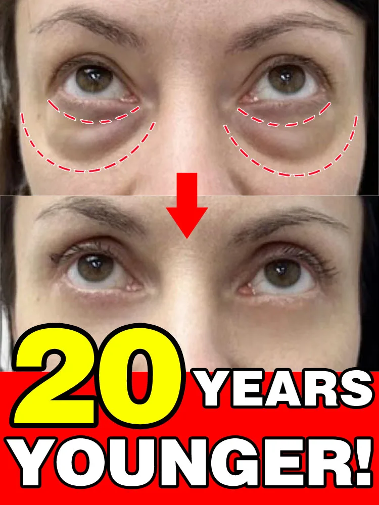 Eye Bags Cream Remove Eyes Wrinkle