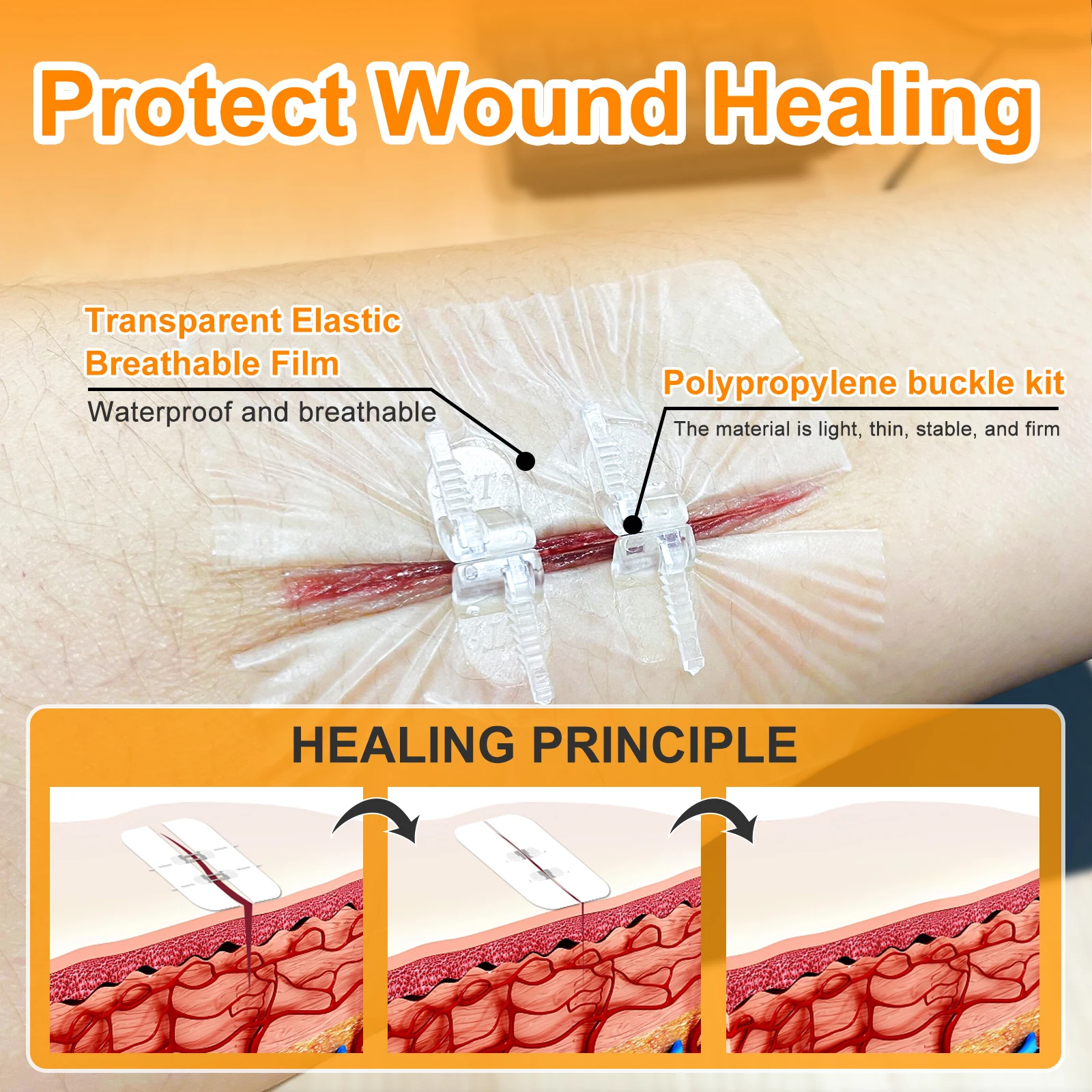 CARBOU 2PCS Zipper Band-aid Painless Wound Closure Device Suture-free Wound Dressing Patches Zip Suture Reducer Band Aid