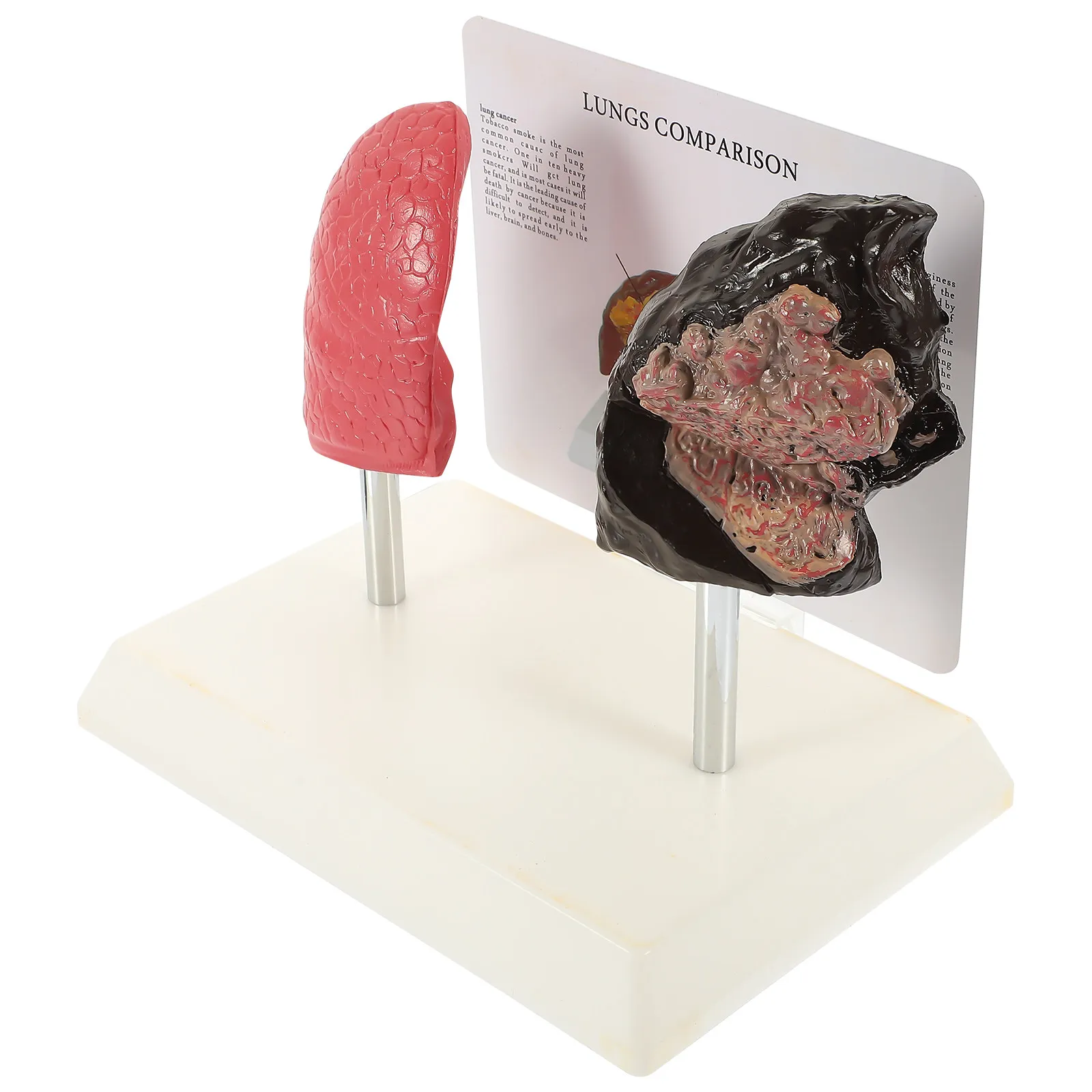 

1Pcs Lung Anatomy Teaching Smoking Lung Comparison Pathological Respiratory School Demonstration Comparison